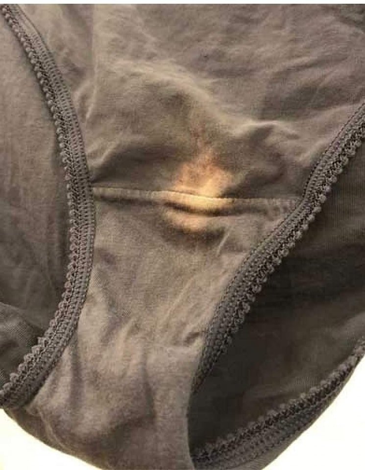 If You Find A “Bleach” Patch On Your Underwear, You’d Better Know What It Means